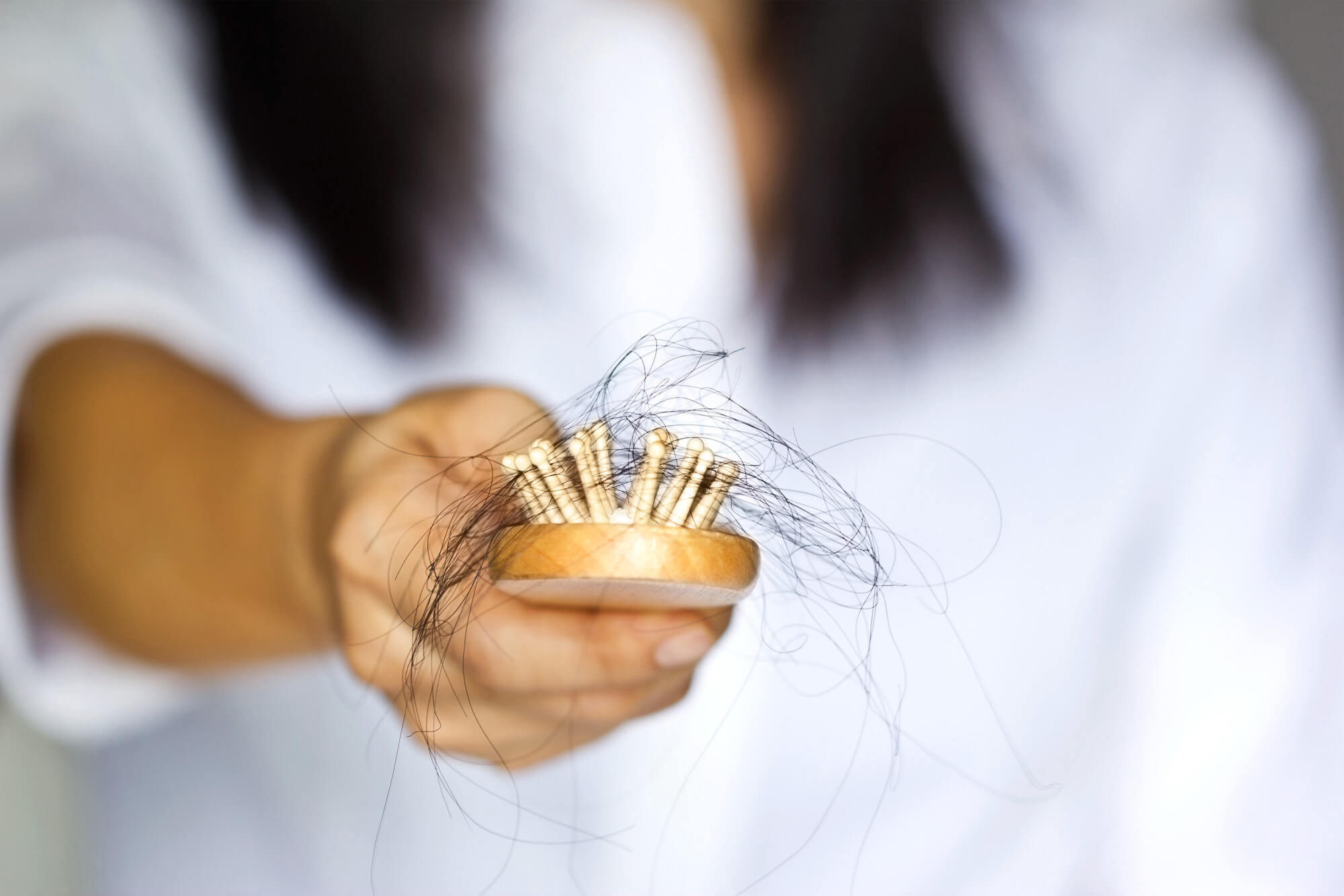 How to Stop Hair Loss Due to Medication