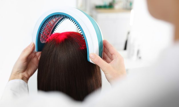 4 Best laser devices for hair loss